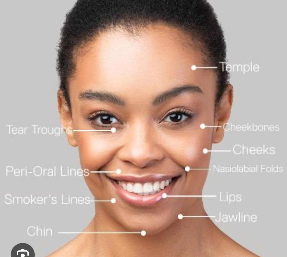 Fillers at Beauty Connection  LLC in Danville, KY