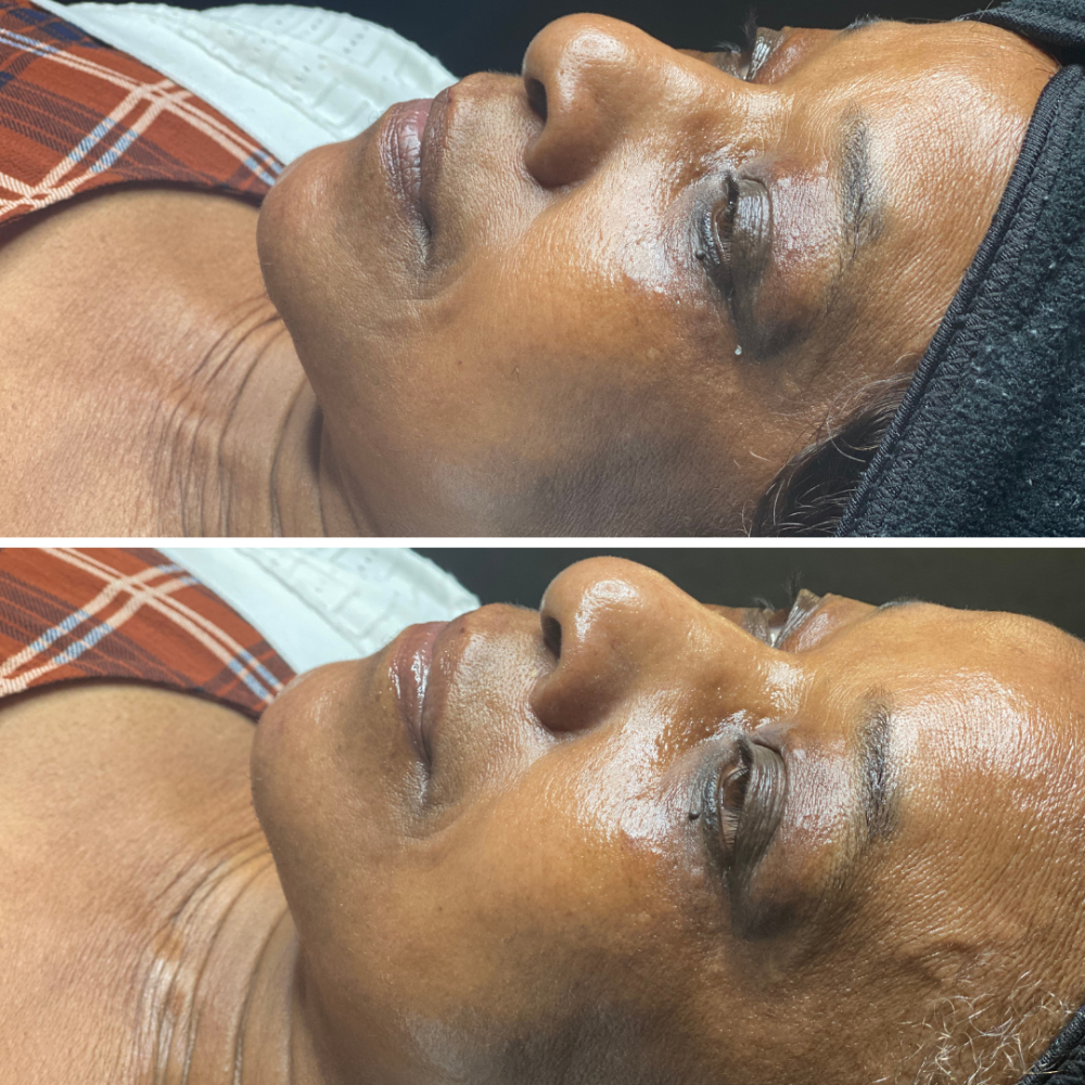 Timeless Glow Facial (Anti-Aging)