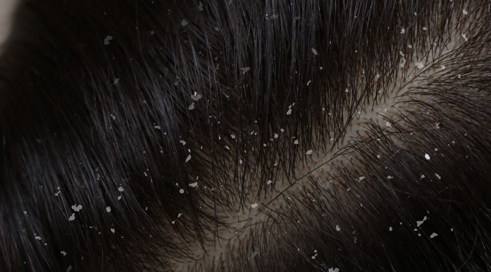 Scalp & Wellness Therapy