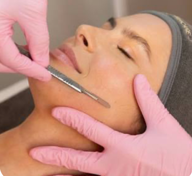 Dermaplaning