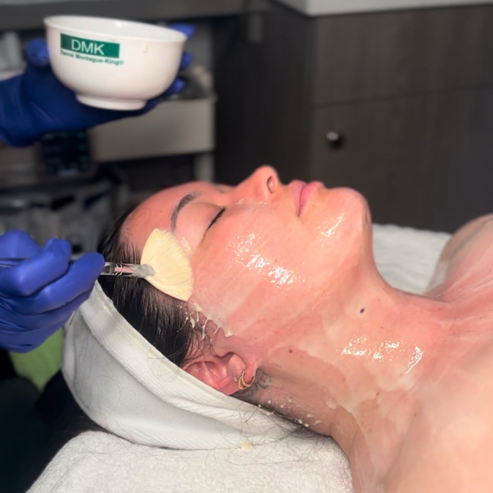 New Client DMK Enzyme Mask at Cherry Glaze Esthetics in Camarillo, CA