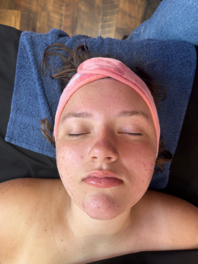 Teen Facial