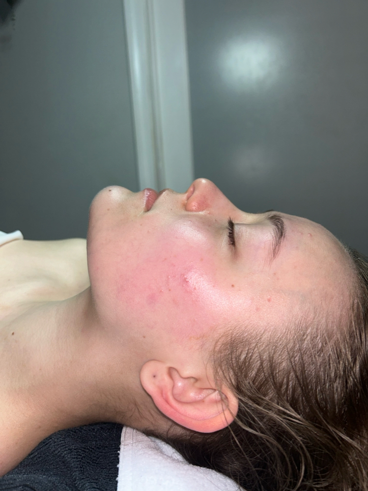 Teen Facial