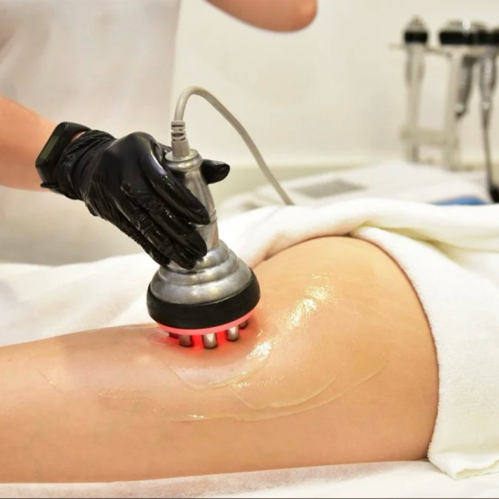 Radio Frequency Skin Tightening at SapphireHatchet Esthetics