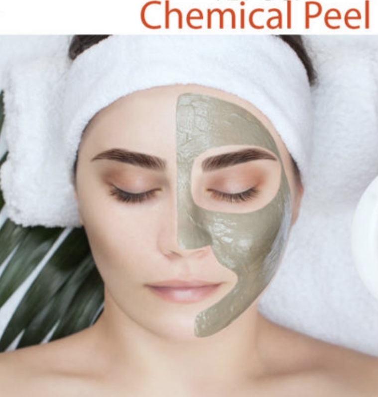Chemical Peel Facial