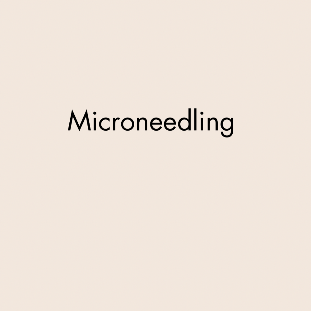 Microneedling (1 Area)