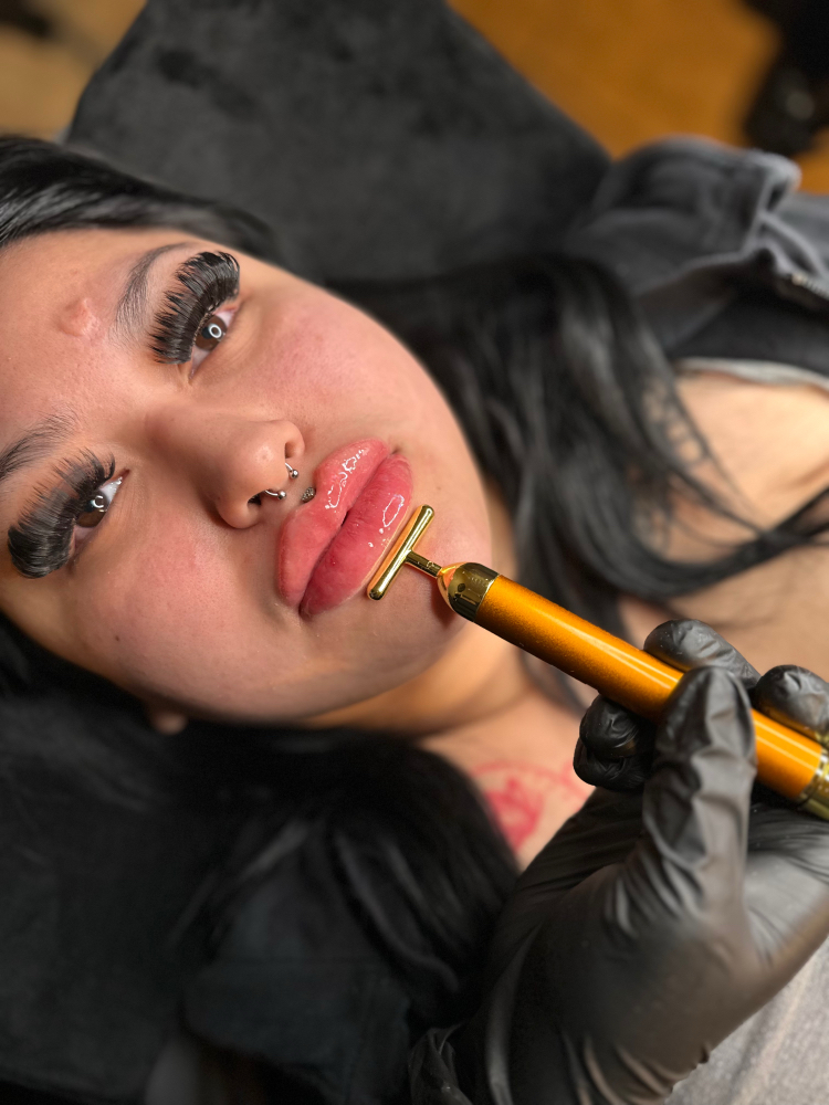 lip filler 2mL