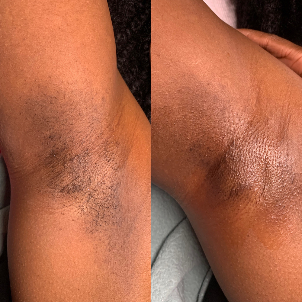 Underarm Wax