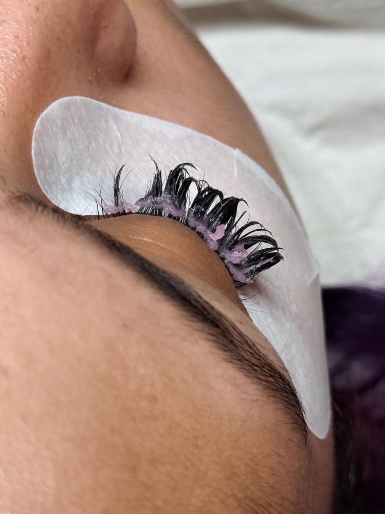 Removal at Mi Vida Beauty in Tucson, AZ