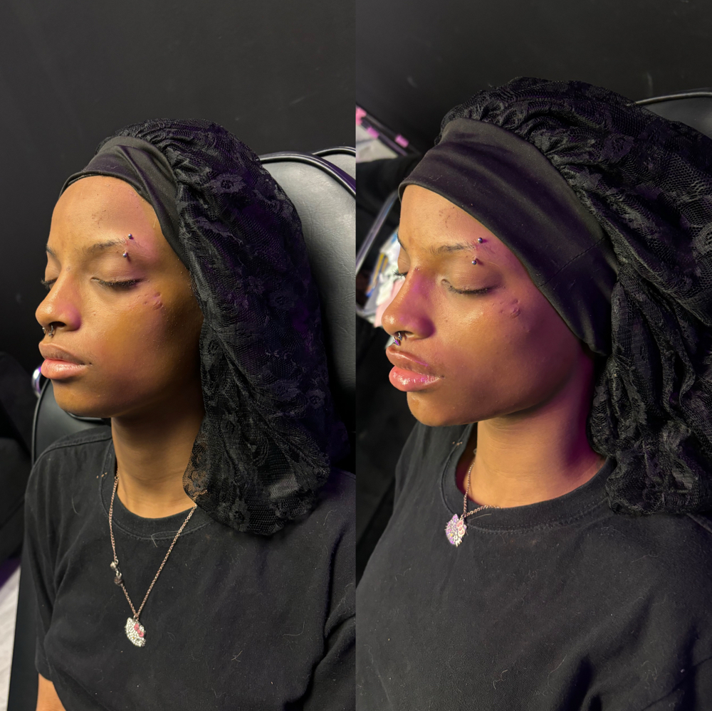 The Glow Up 🌟 Package at Perfection Injections in Euless, TX