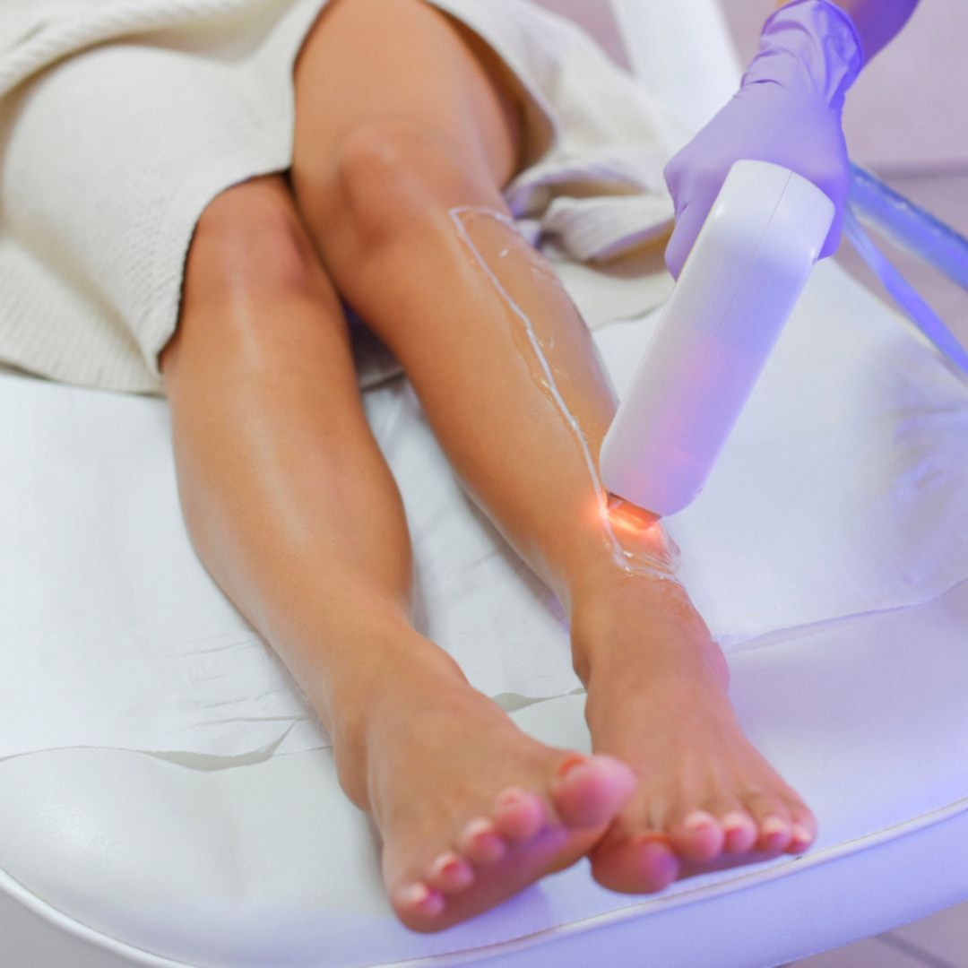 Laser hair removal at Beleza Medspa in Denton, TX