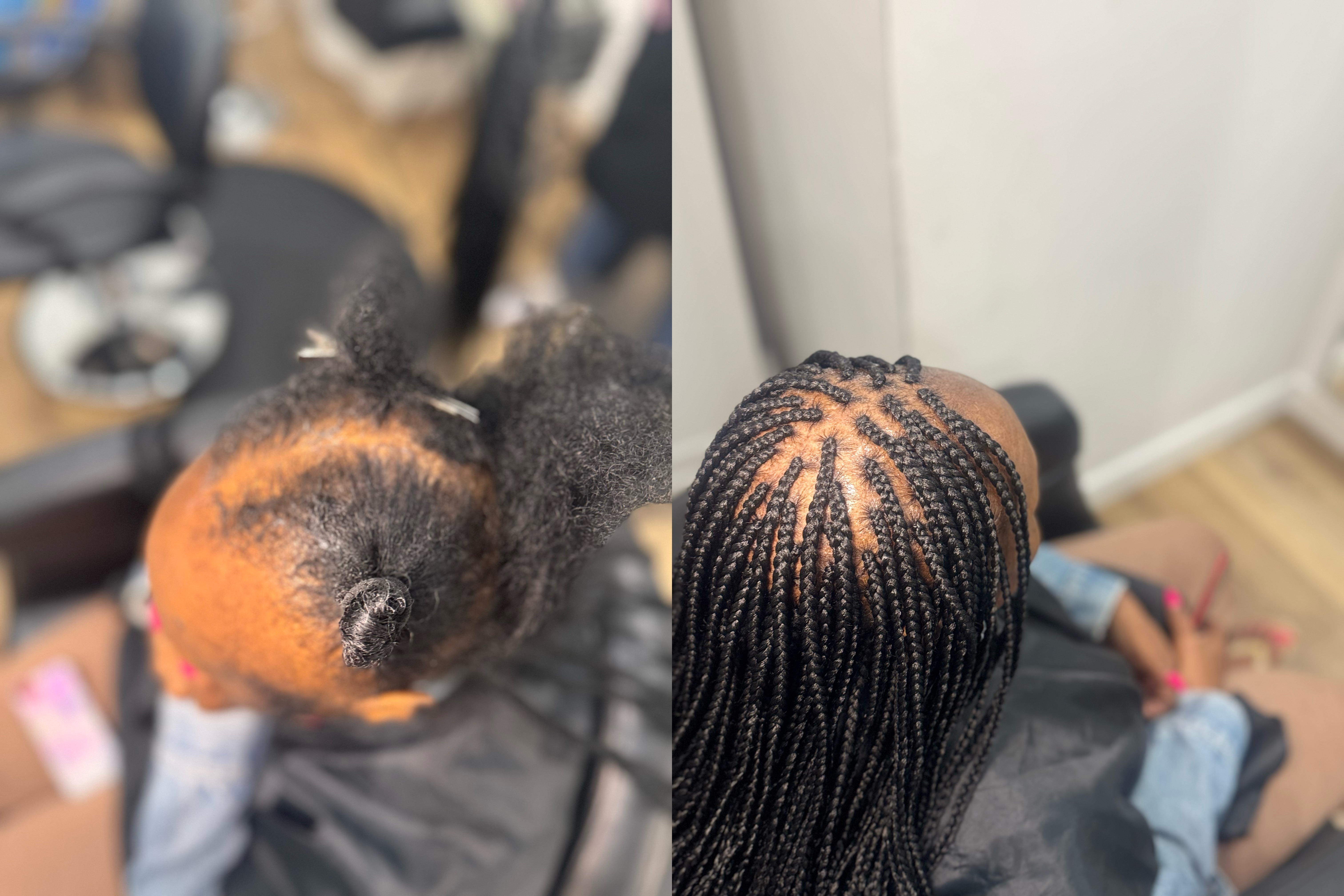 Small Individual With alopecia at Michou  HairBraiding in Anaheim, CA