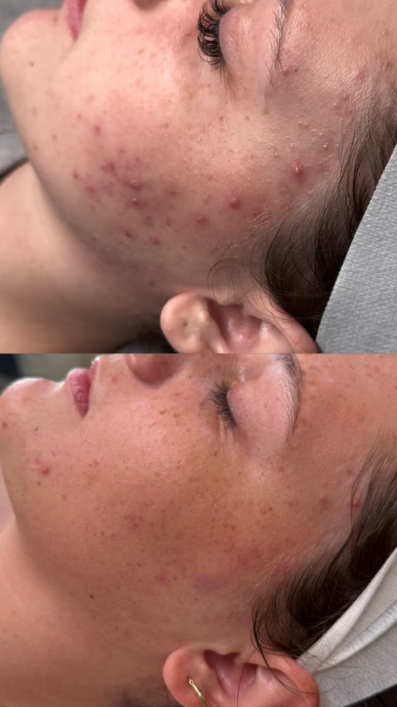 Face Reality Facial