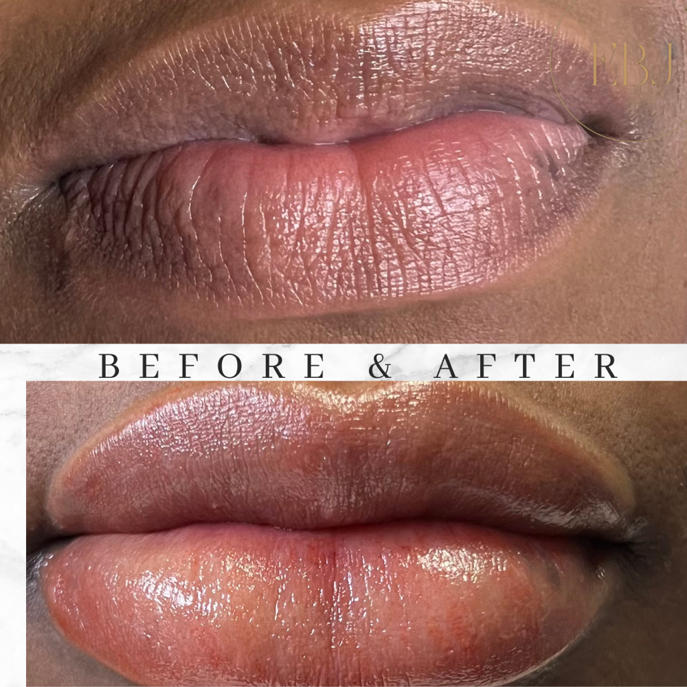 Lip Neutralization Tattoo