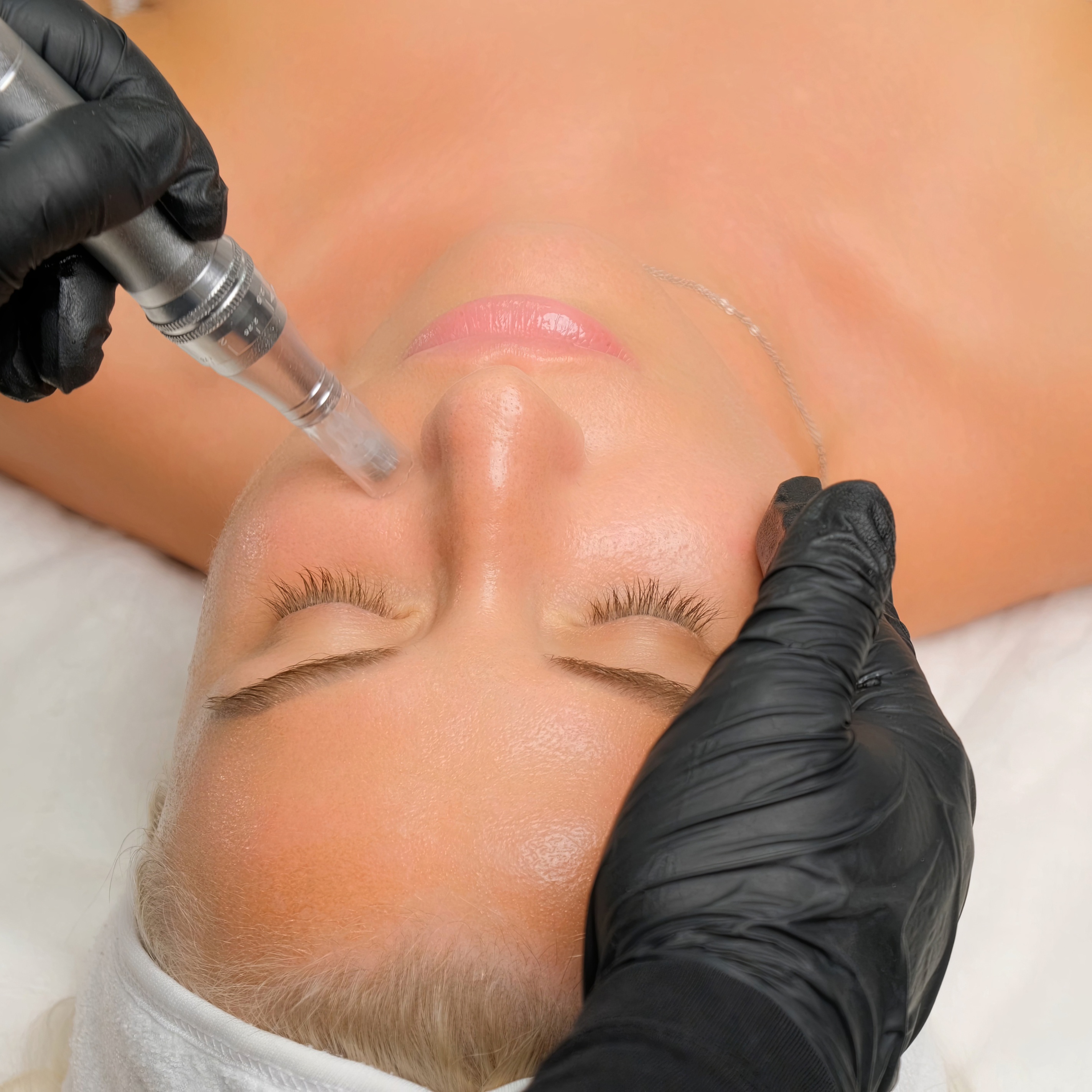 The Metamorphix Method at Metamorphix Skin in Gaithersburg, MD
