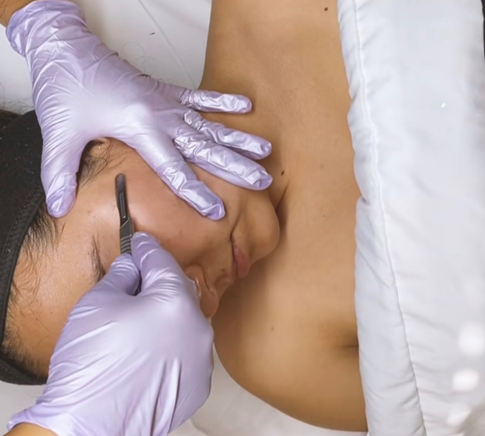 Dermaplaning Facial