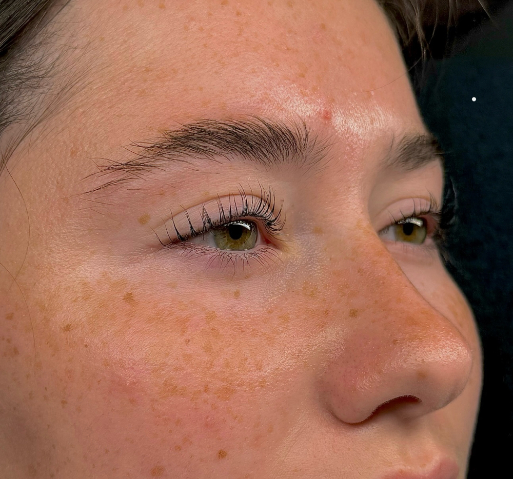 Lash Lift Treatment