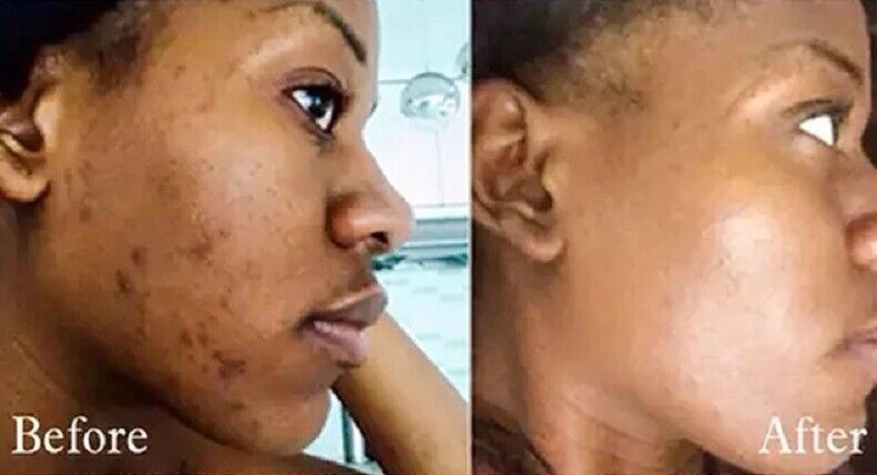 Brightening Facial