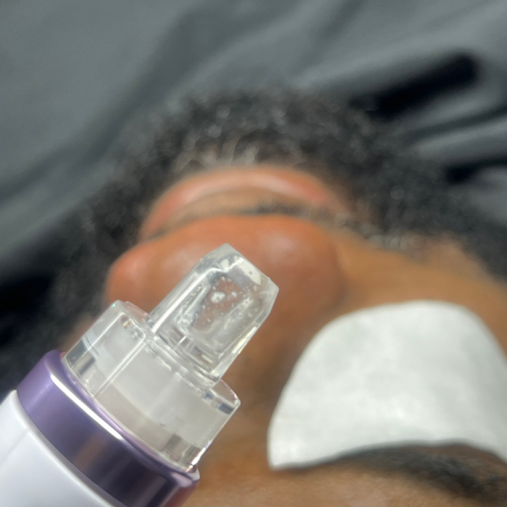 Glow and Go Facial (Women Or Men) at Radiant Eyes & Aesthetics in Petal, MS
