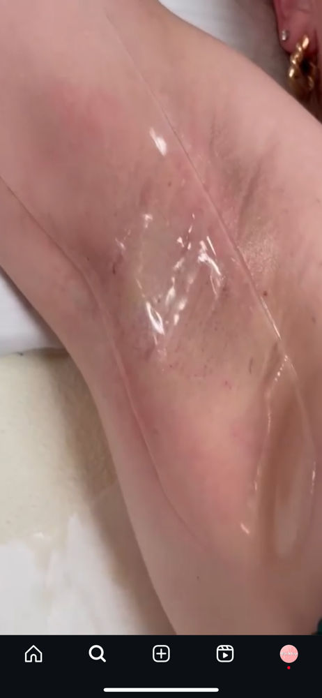 Underarm Hydrogel Mask Add-on