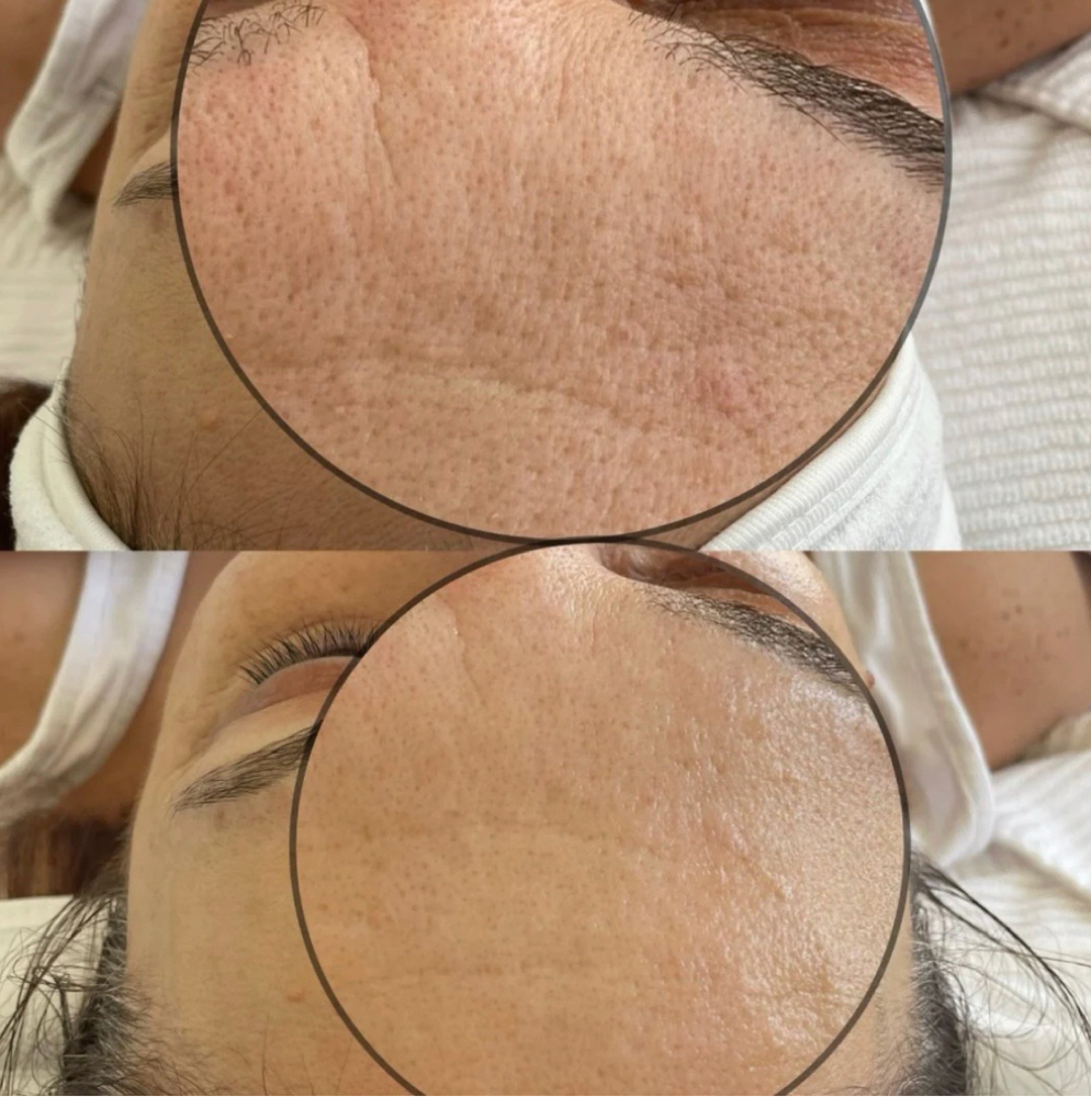 Lift And Glow Edit Facial at The Full Edit Aesthetic Studio in Florence, AL