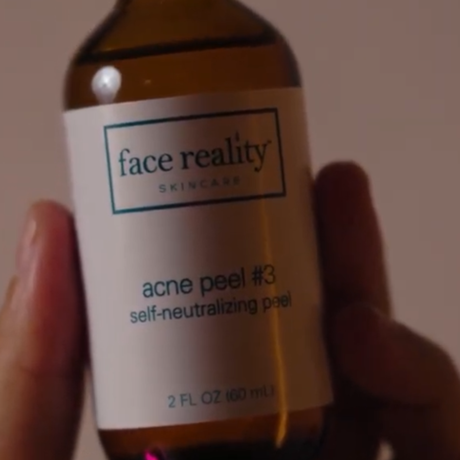 Acne Reset Program (Initial) at Narrative Skin Studio in Dallas, TX