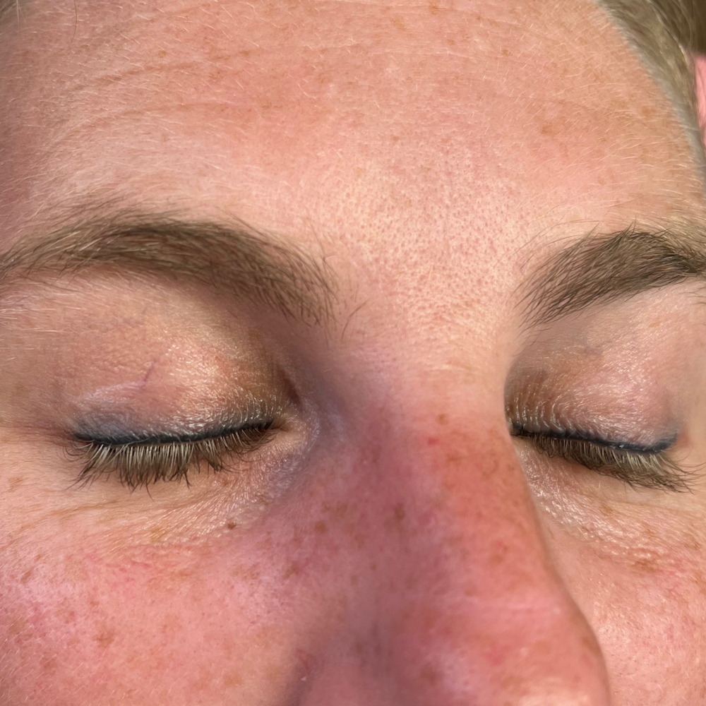 Permanent Eyeliner (Top Lid)