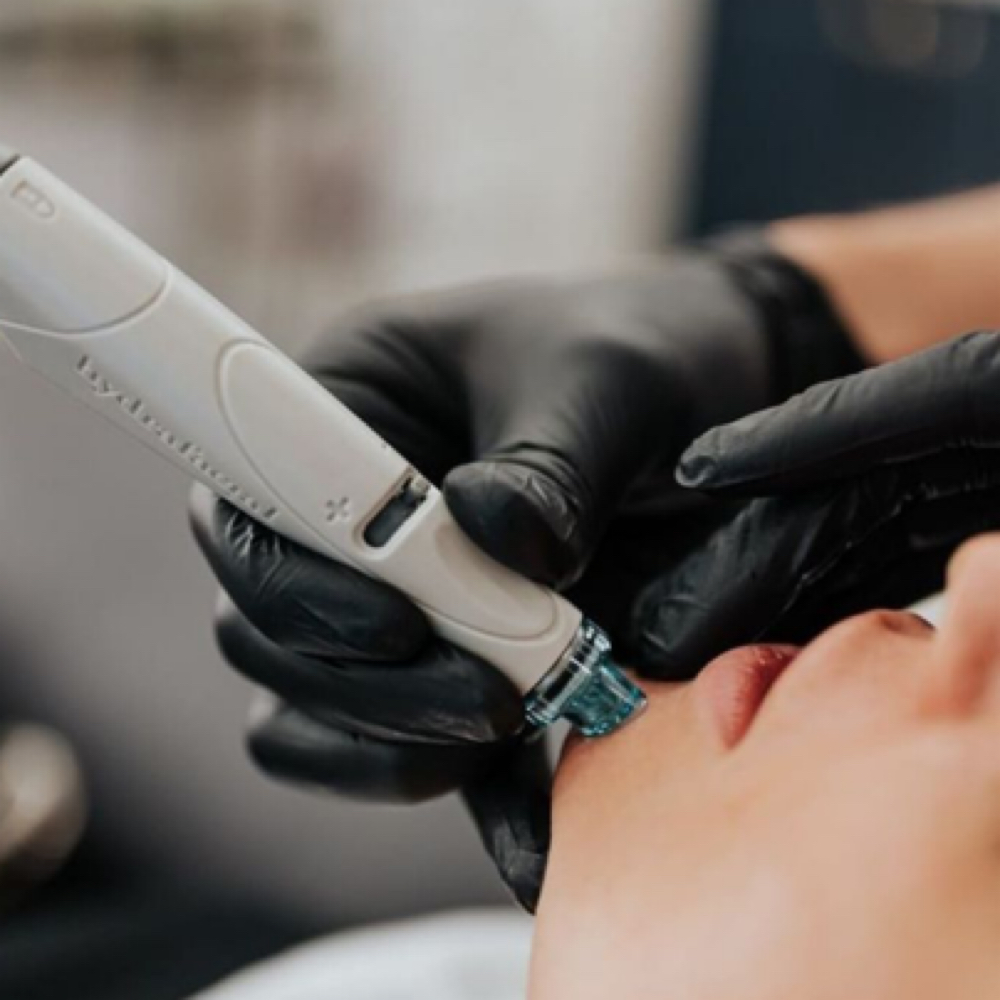 Add on - Hydrodermabrasion at Esthetics by Kaiya in Bedford, NH