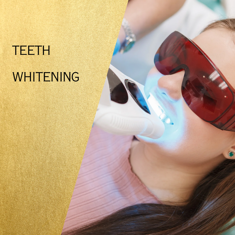 Teeth Whitening