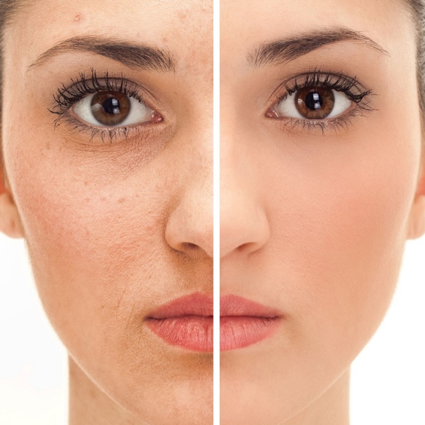 Rejuvenation Facial at Salon & Spa At Cambridge Wilmington in Wilmington, NC