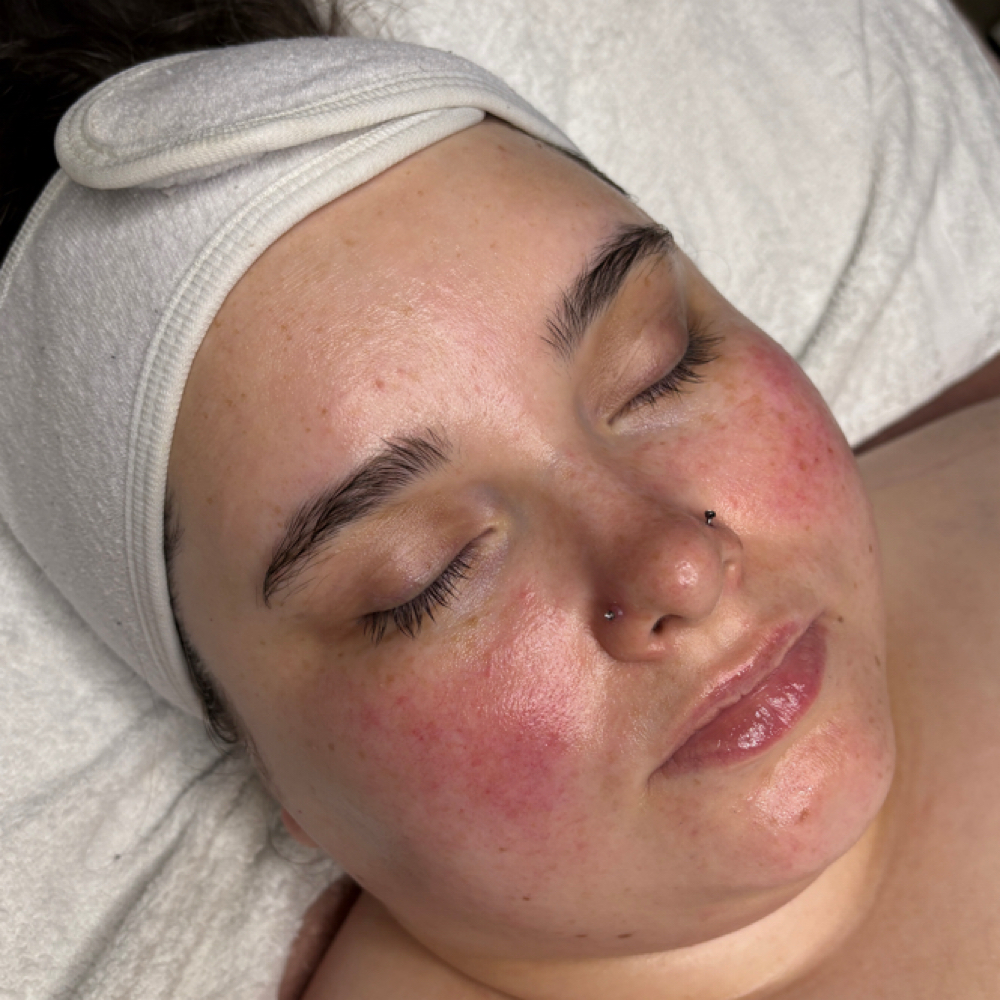 The Clarifier Facial at YasFleuraEsthetics in Springdale, AR