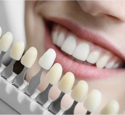 Teeth Whitening (45 Minutes)