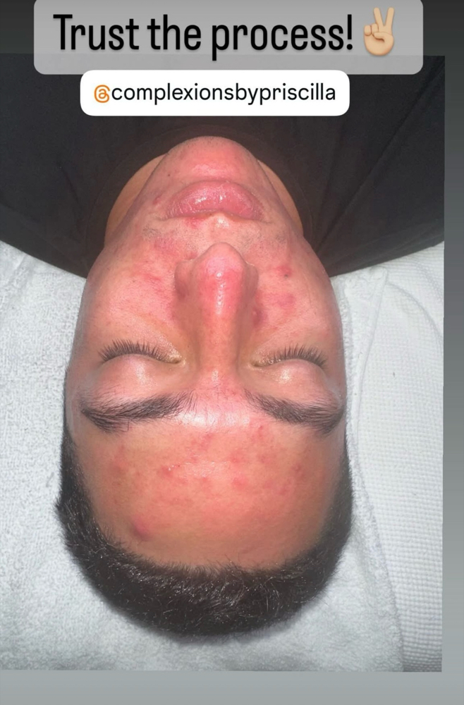 Mens Facial
