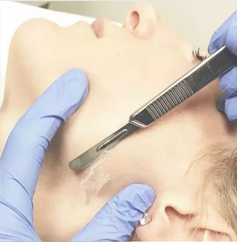 Dermaplane