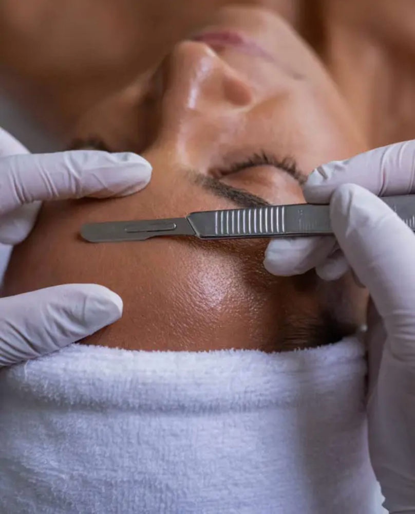 Facial Con Dermaplane