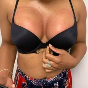 Boob Lift