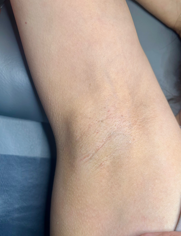 Under Arm Wax