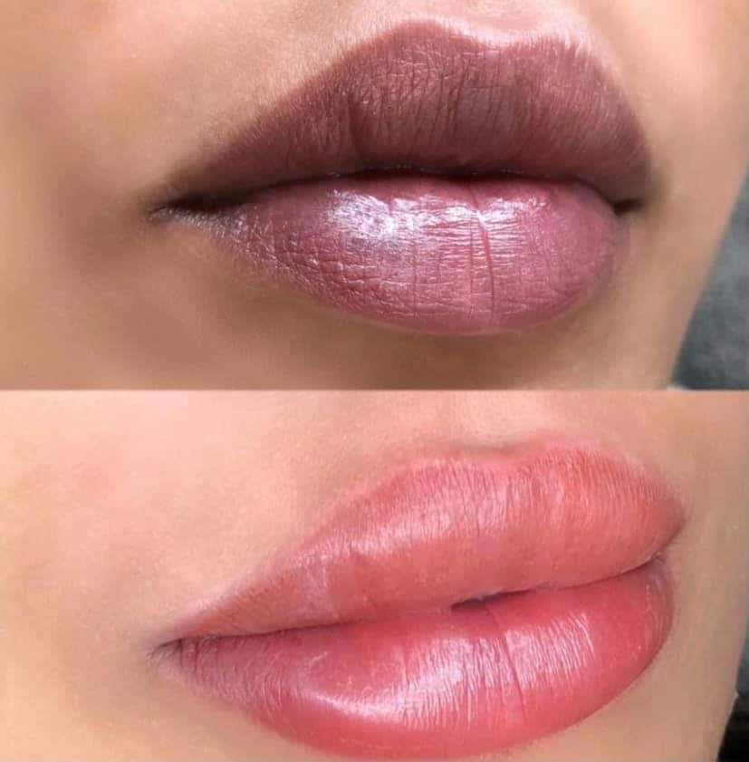 Lip Neutralization