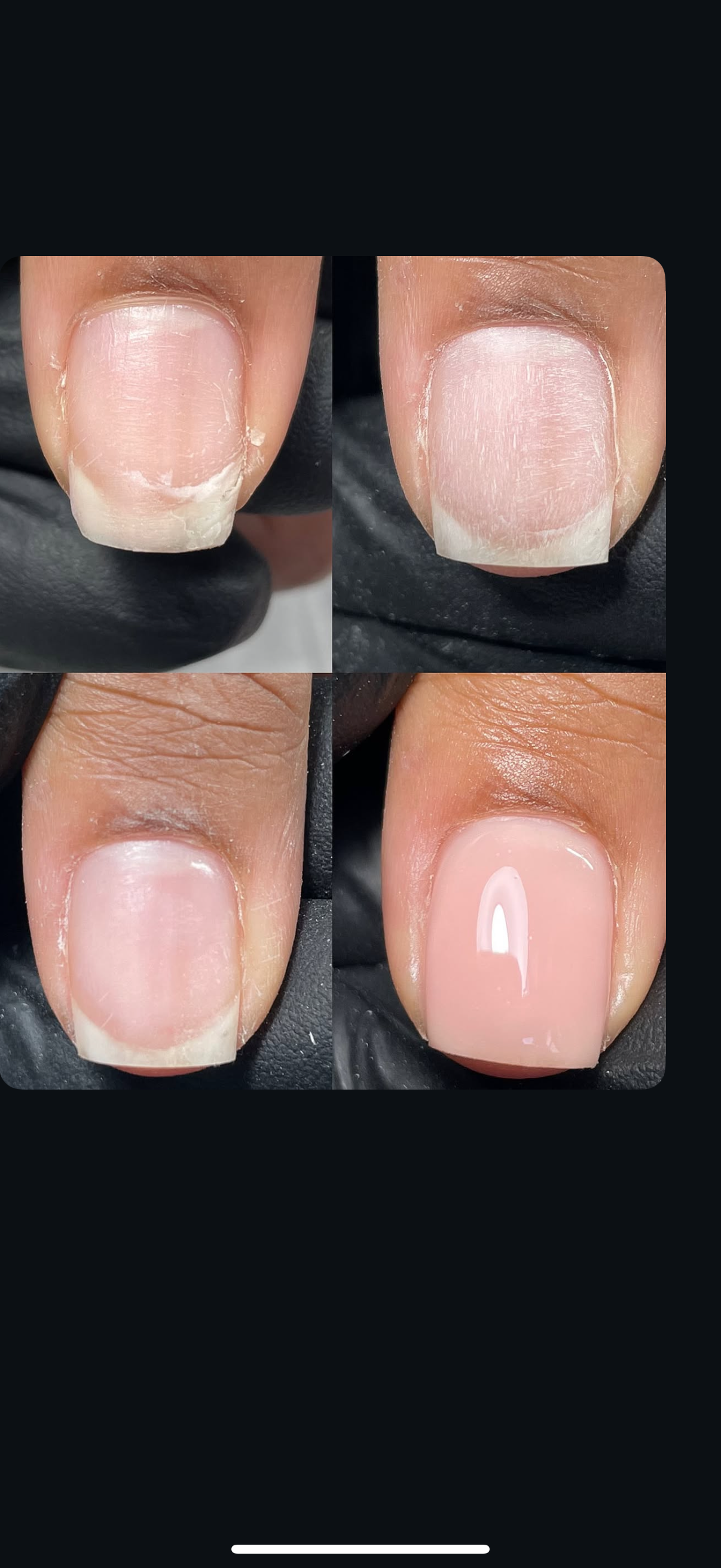 Nail Repair