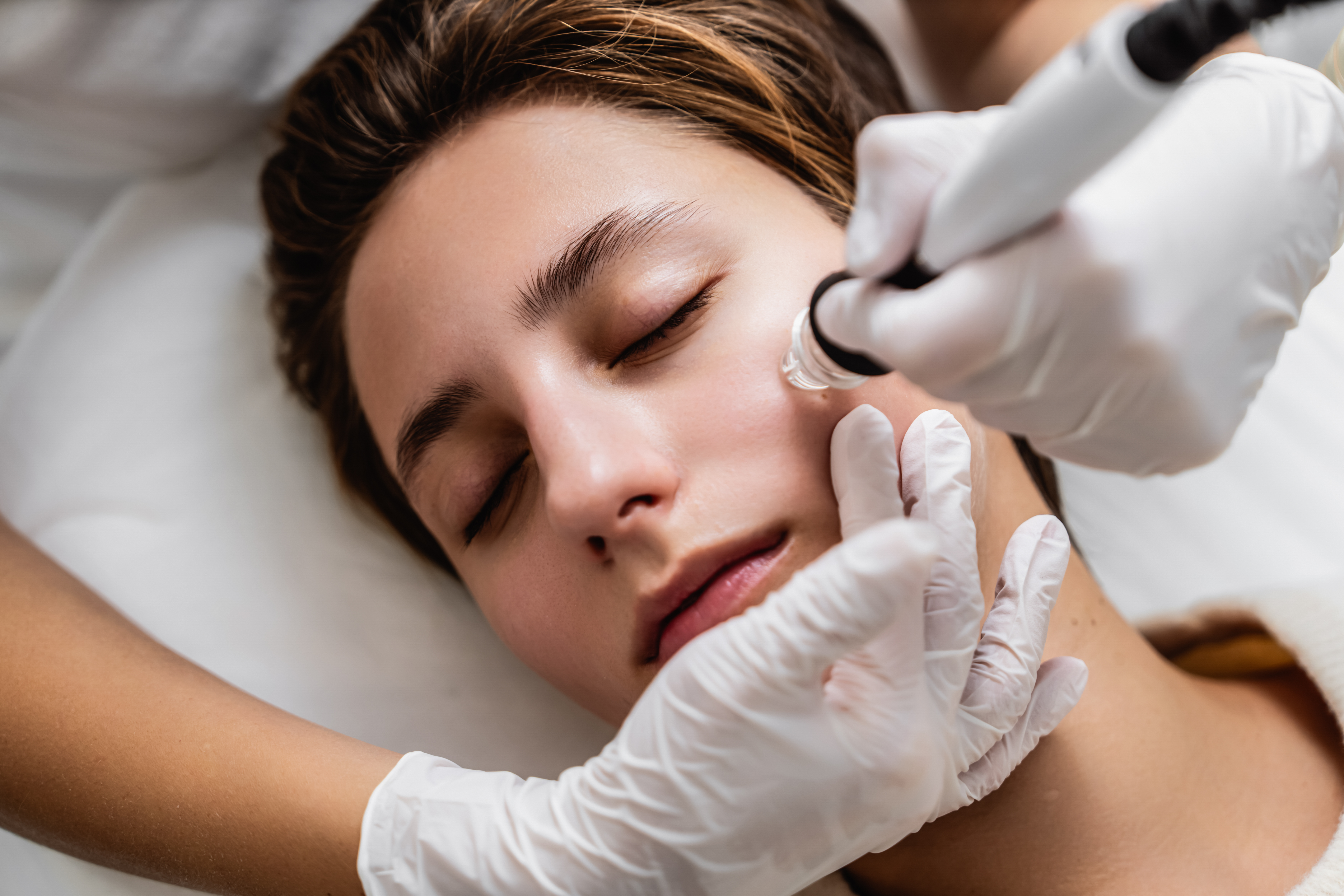 Microdermabrasion Express