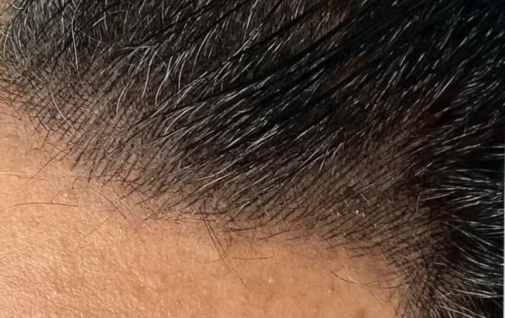 SMP Nano Hair/ Hairline Only at The Beauty Bar Ink in Huntsville, AL