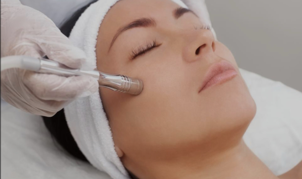 Microdermabrasion