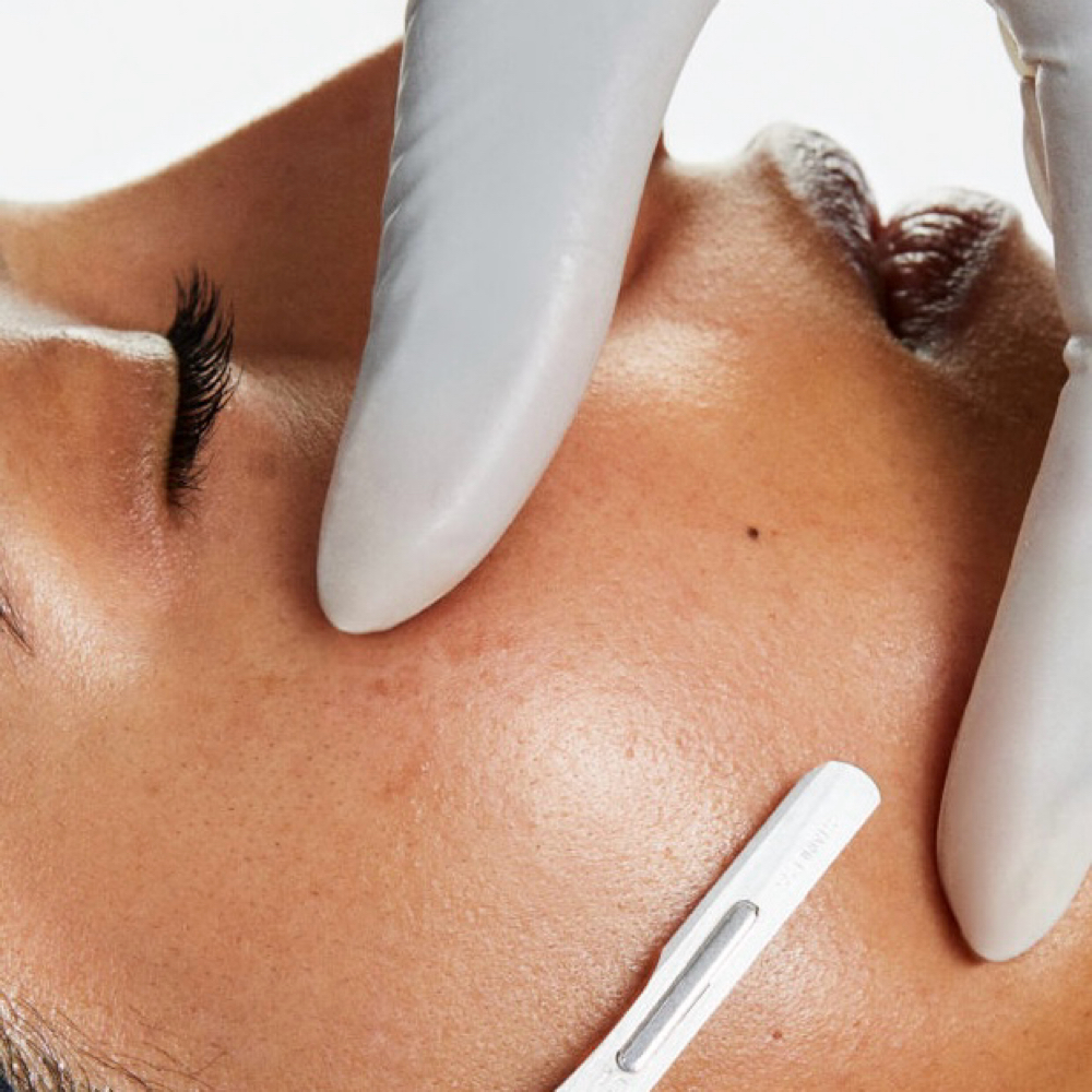 Dermaplane Add-on at Glass Skin Studio in West Bloomfield, MI