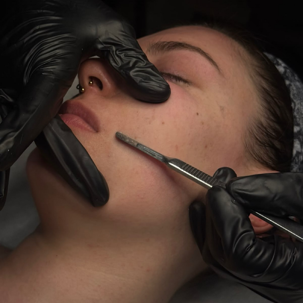 Dermaplane Facial at Elevate Aesthetics in Sandy, UT