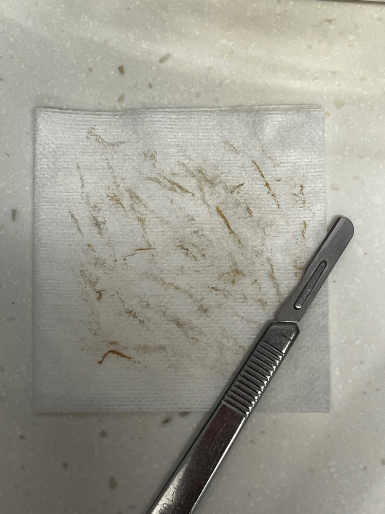 Express Dermaplane Facial at Bare Face Beauty LLC in Greenwood, IN