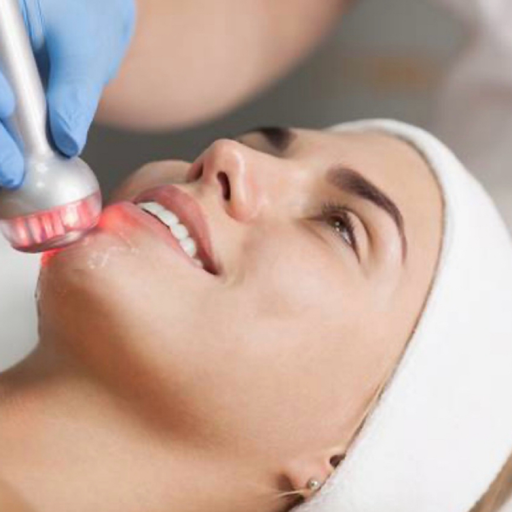 Radio, Frequency Firming at Carrie Hodgins