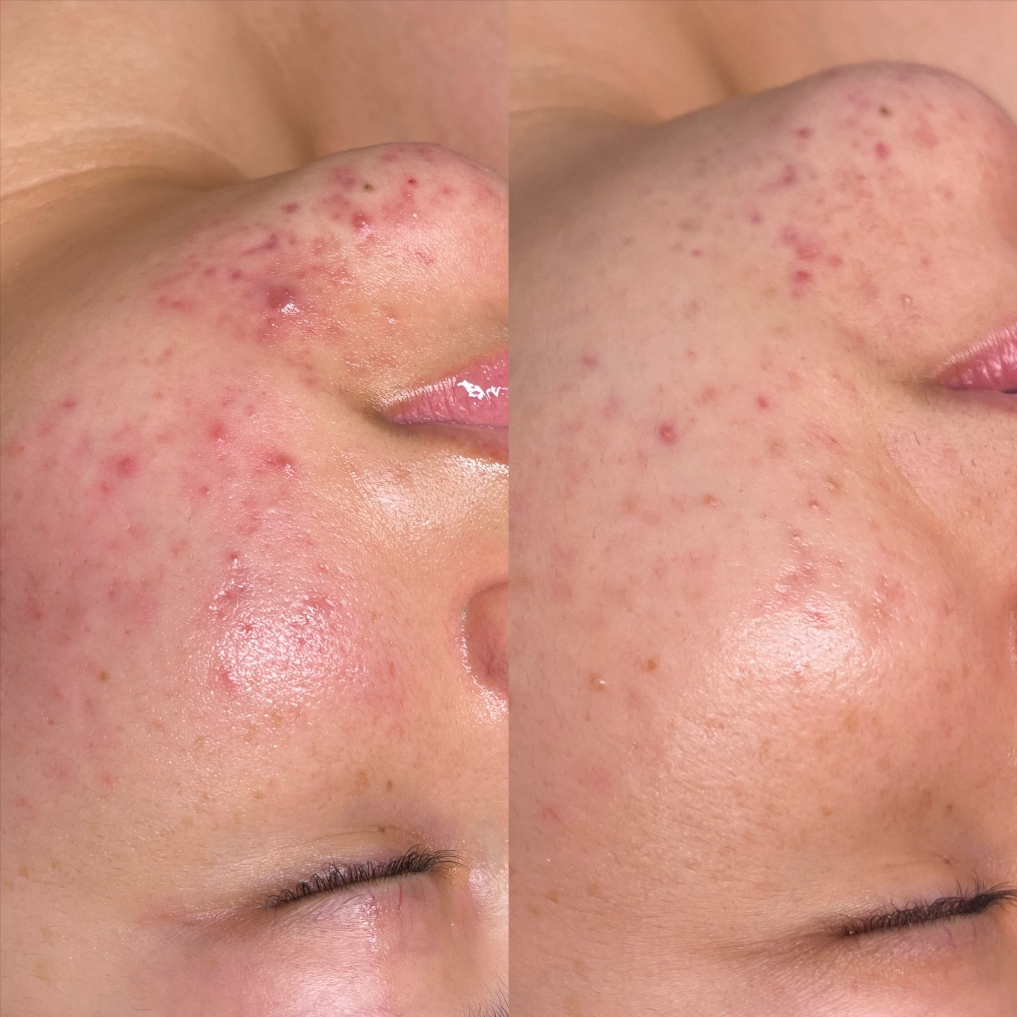 Soothe & Shield at Love Beauty Lounge in Victorville, CA