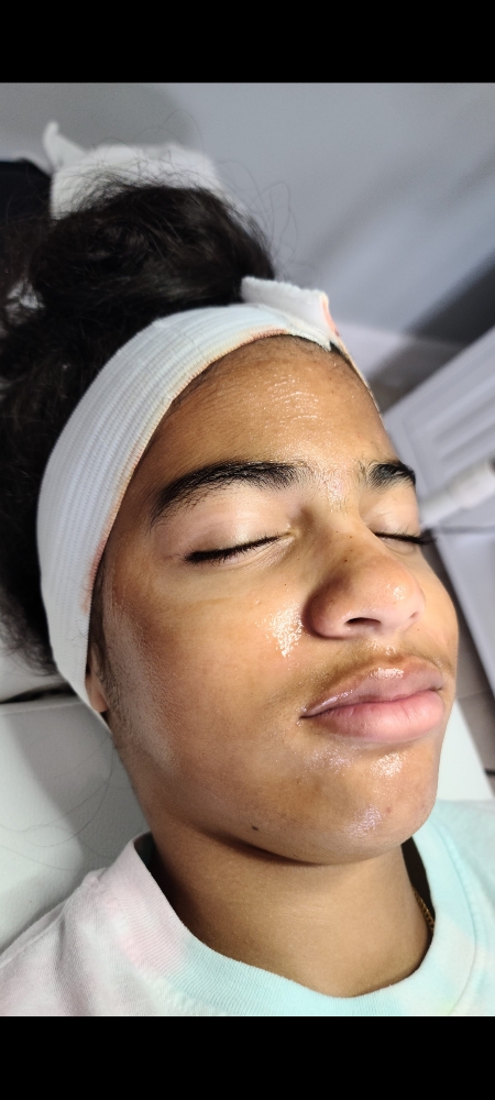 Teen Facial.