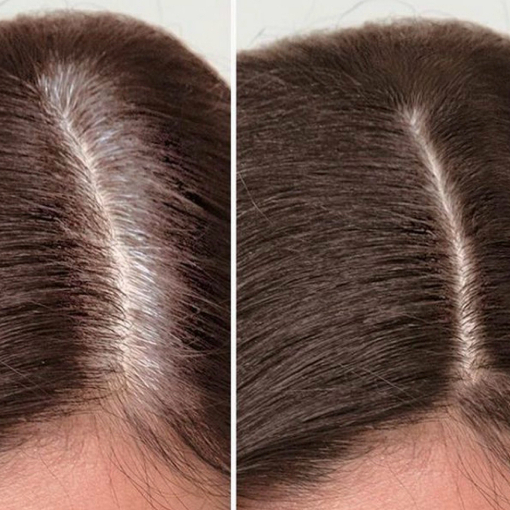 Gray Touch-Up at ABstyles in Conshohocken, PA