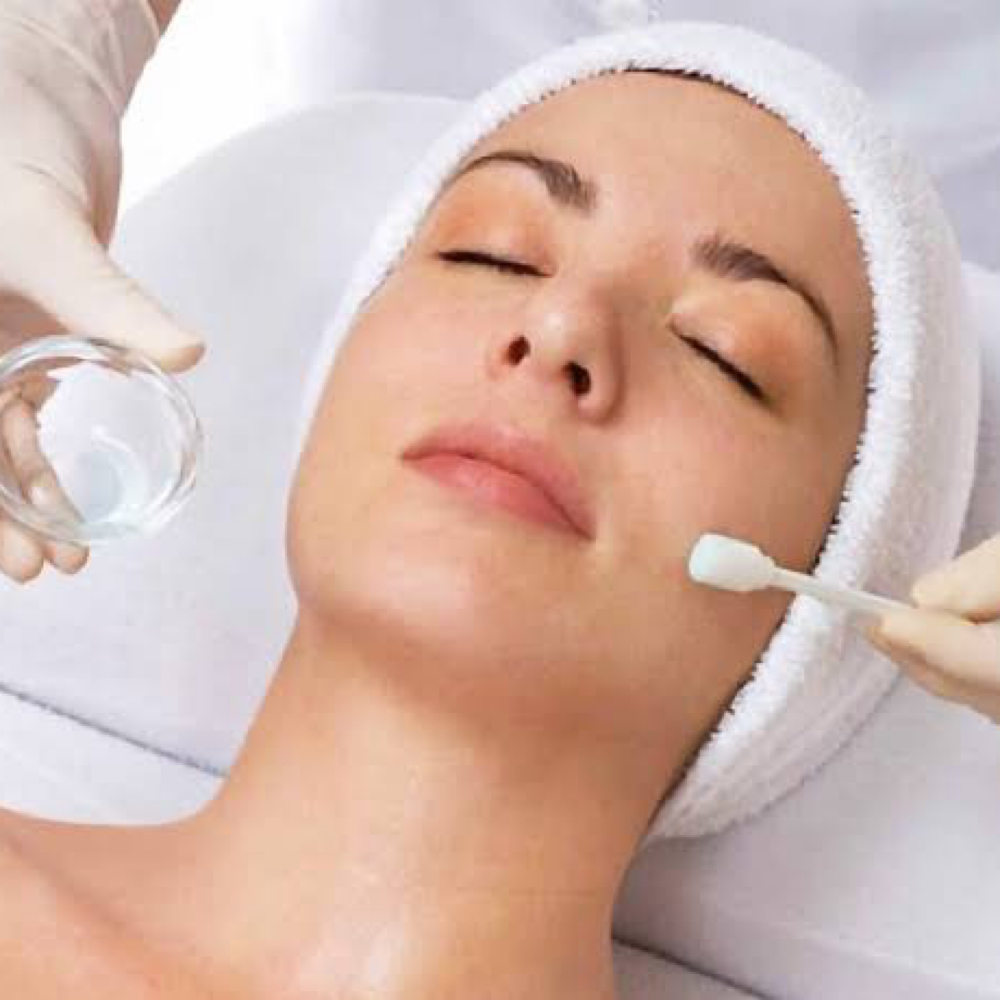 Luminescence Renewal Peel at SkinUpgradeMD in Charlotte, NC